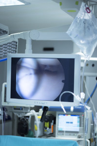 Hospital surgery arthroscopy operation screen